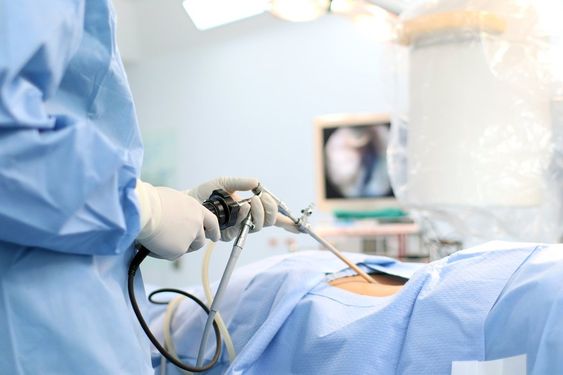 Laparoscopic Surgery Explained